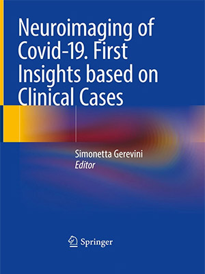 دانلود کتاب Neuroimaging of Covid-19. First Insights based on Clinical Cases