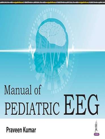 دانلود کتاب Manual of Pediatric EEG 1st Edition