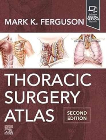 دانلود کتاب Thoracic Surgery Atlas 2nd Edition