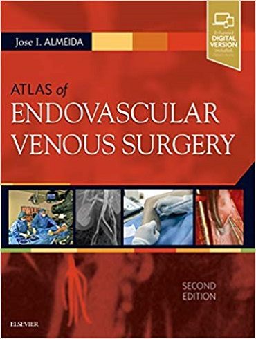 دانلود کتاب Atlas of Endovascular Venous Surgery 2nd Edition