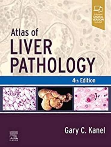 دانلود کتاب Atlas of Liver Pathology 4th Edition - Image 2