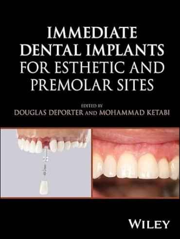 دانلود کتاب Immediate Dental Implants for Esthetic and Premolar Sites 1st Edition