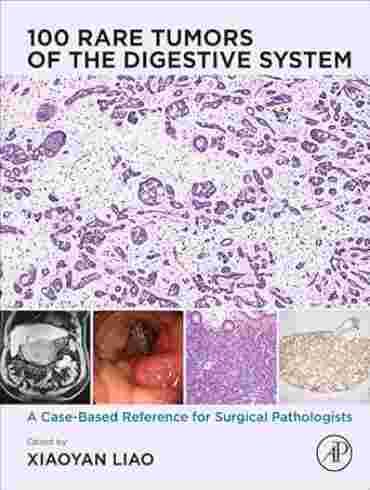 دانلود کتاب The 100 Rare Tumors of the Digestive System: A Case-Based Reference for Surgical Pathologists 1st Edition