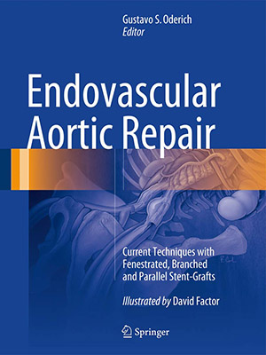 دانلود کتاب Endovascular Aortic Repair: Current Techniques with Fenestrated, Branched and Parallel Stent-Grafts