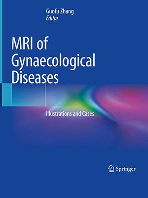 دانلود MRI of Gynaecological Diseases: Illustrations and Cases