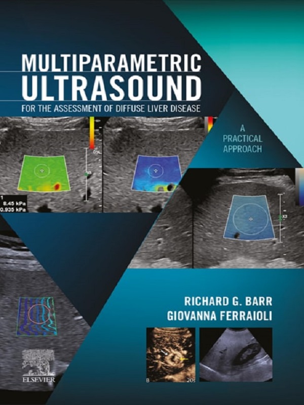 دانلود کتاب 2024 Richard G Barr, Giovanna Ferraioli Multiparametric Ultrasound
