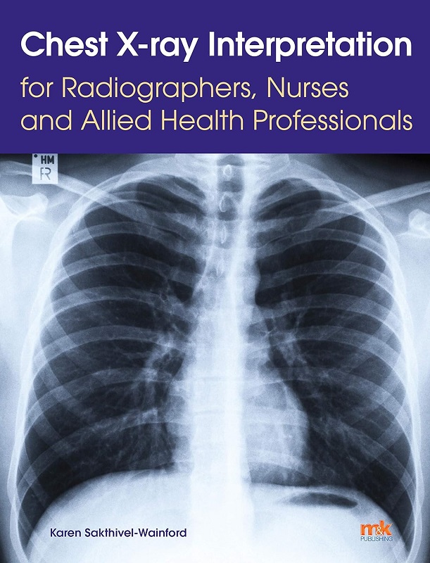 دانلود کتاب Chest X-ray Interpretation for Radiographers, Nurses and Allied Health Professionals