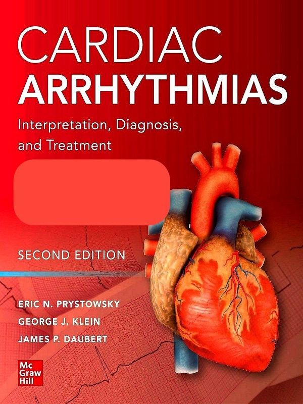 دانلود کتاب Cardiac Arrhythmias Interpretation, Diagnosis And Treatment 2nd