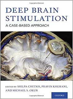 دانلود کتاب Deep Brain Stimulation: A Case-based Approach