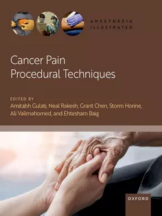 دانلود کتاب Cancer Pain Procedural Techniques (Anesthesia Illustrated)