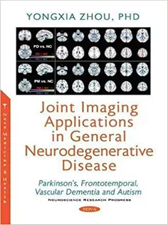 دانلود کتاب Joint Imaging Applications in General Neurodegenerative Disease