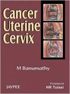 دانلود کتاب Cancer Uterine Cervix 2007